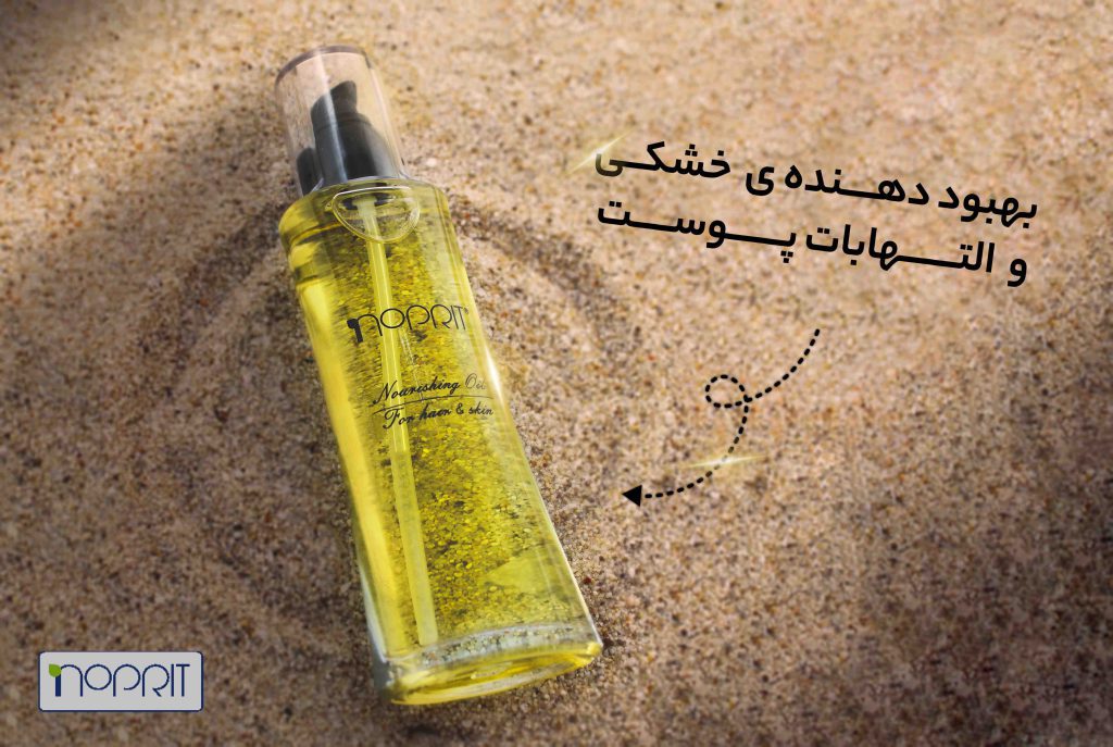 آفتاب سوختگی